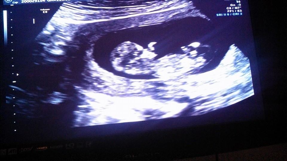 Baby2 12 weeks.jpg