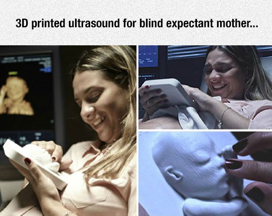 cool-blind-woman-mother-ultrasound-3D.jpg
